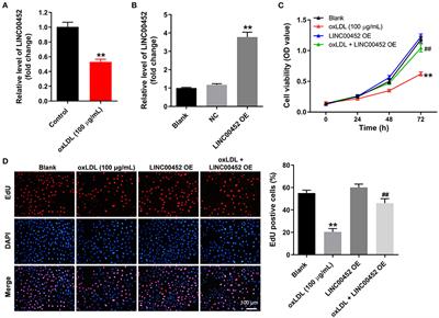 LINC00452 overexpression reverses oxLDL-induced injury of human umbilical vein endothelial cells (HUVECs) via regulating miR-194-5p/IGF1R axis